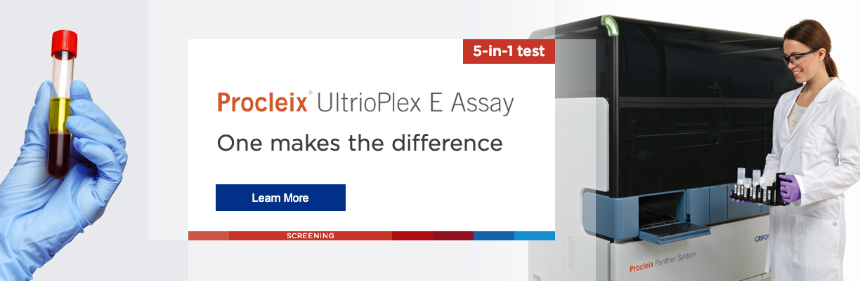 Procleix UltriPlex E Assay