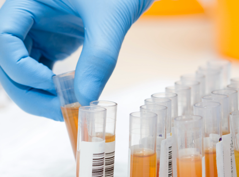 Save Costs With Procleix System