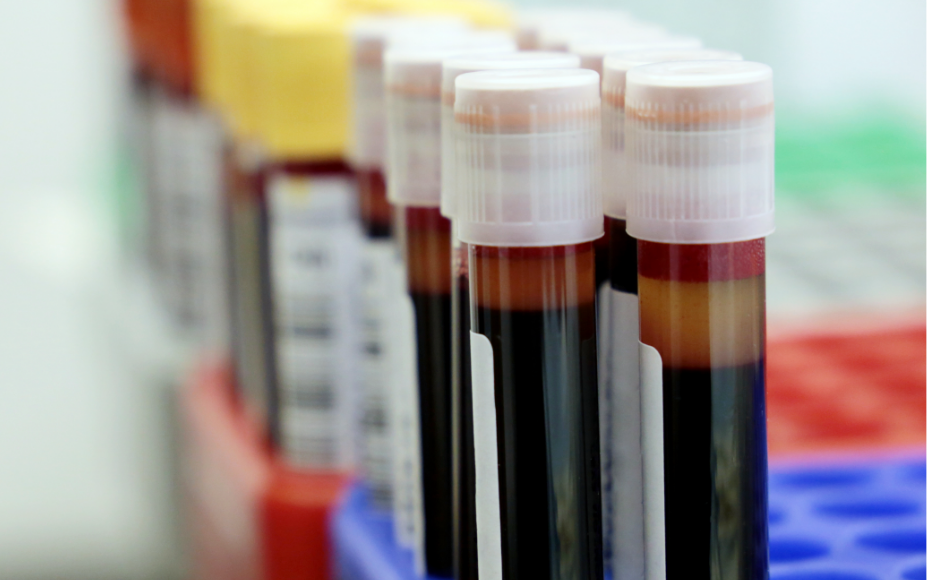 An Overview of Blood Types