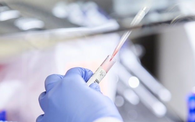 Employee preparing samples of the ID Core XT Test