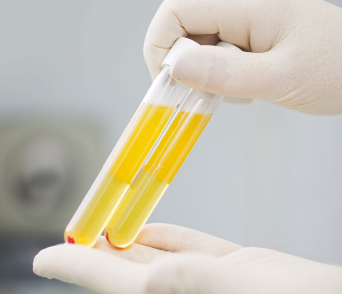 Lab worker holding blood plasma samples