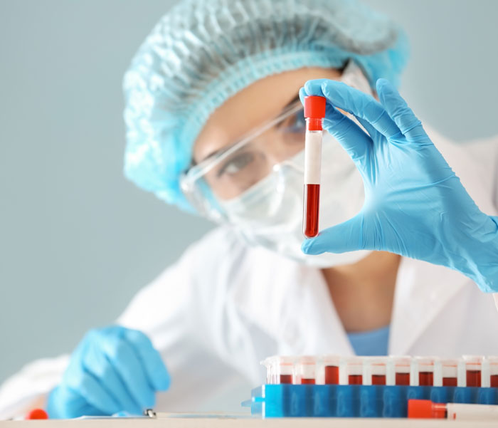 Woman holding test tube with blood sample in the laboratory