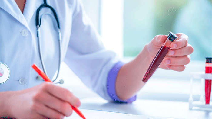 Antiphospholipid Syndrome (APS) Diagnostics