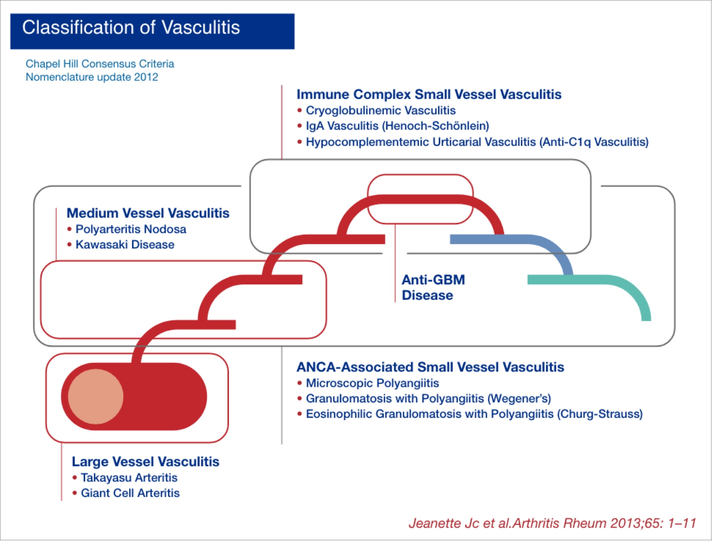 Classifying Types of Vasculitis