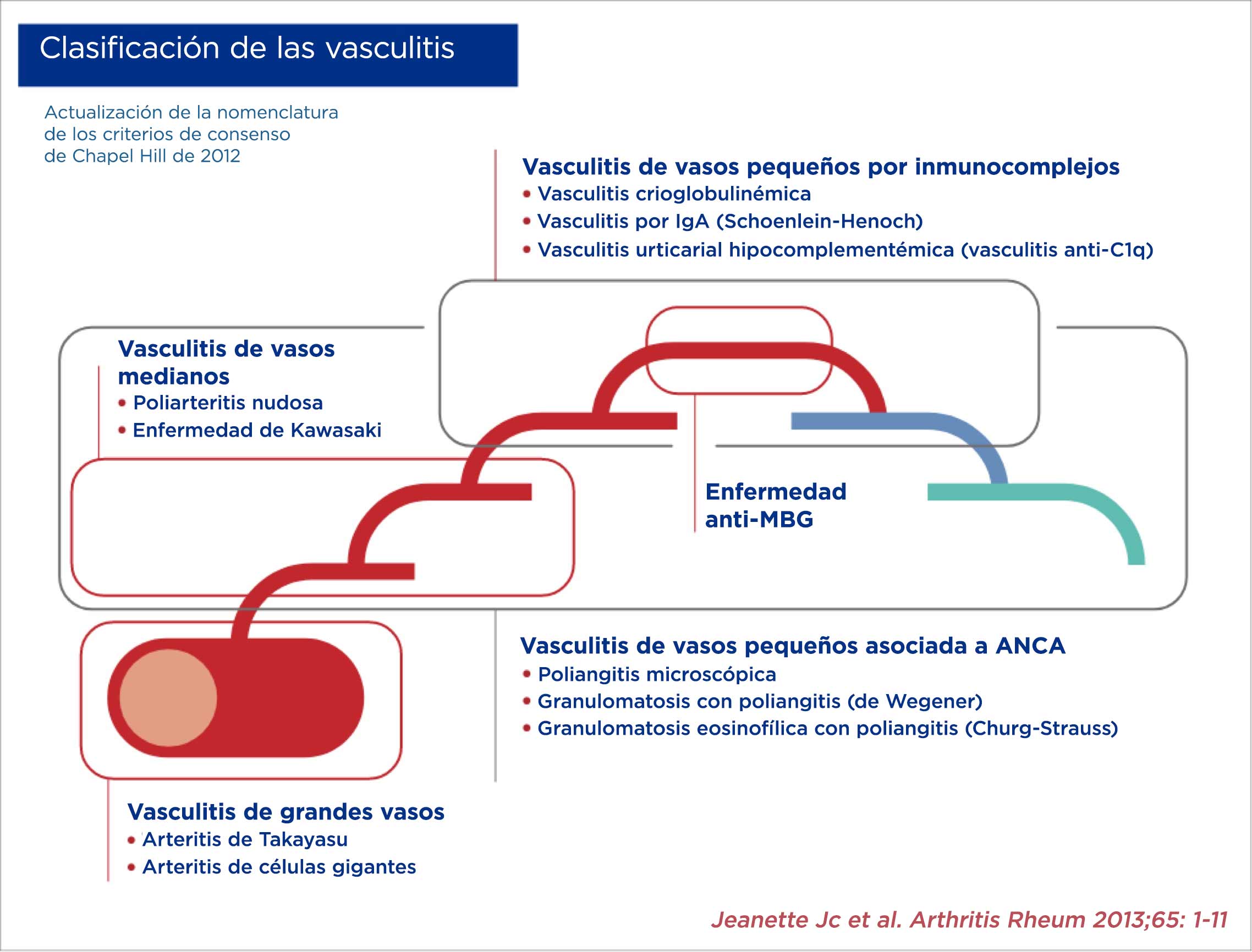 Clasificación de los tipos de vasculitis