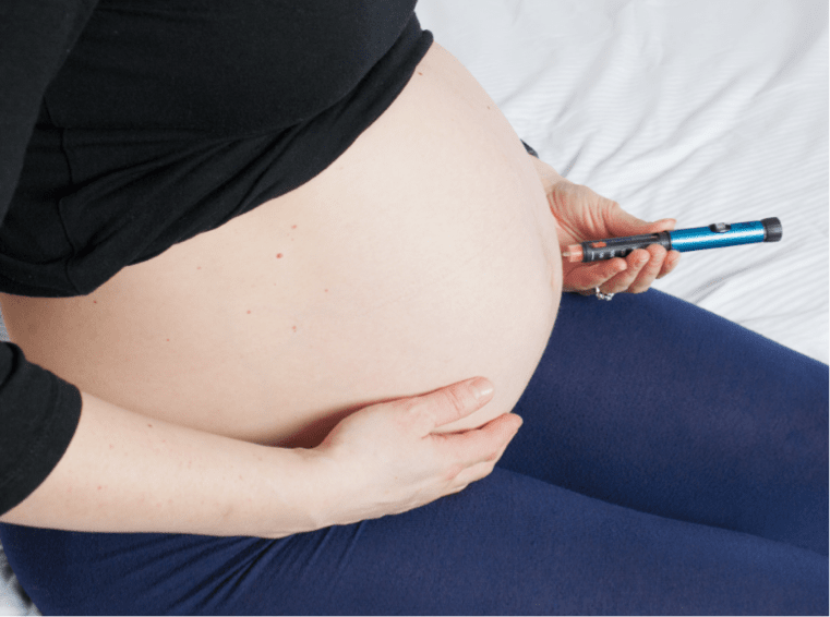 Treatment for Obstetric APS