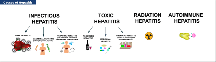 Causes of Hepatitis