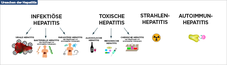 Ursachen der Hepatitis