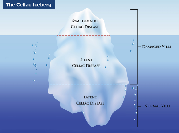 The Celiac Iceberg