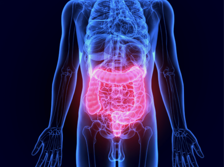 Functional Gastrointestinal Disorders